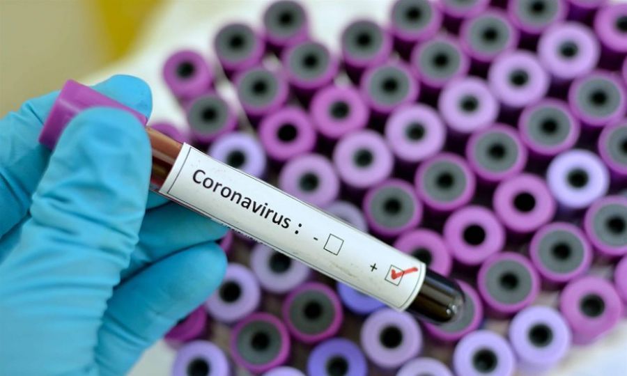 Confirmed coronavirus cases in Cyprus rise to 14