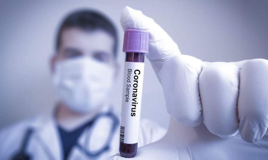 ‘Long way ahead’ as 33 more test positive for Covid-19 in Cyprus