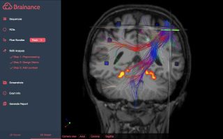 greek-startup-offers-brain-imaging-on-the-web