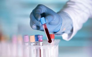 Research gives hope for Mediterranean anemia cure