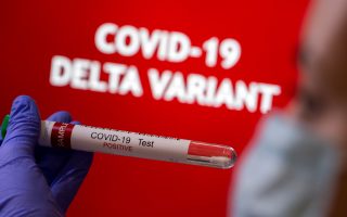 Beyond Delta, scientists are watching new coronavirus variants