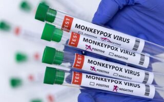 Authorities report 20 confirmed cases of monkeypox