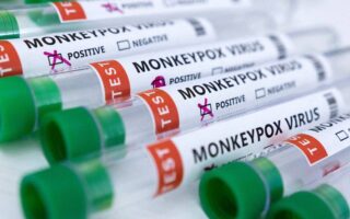 Thirteen confirmed cases of monkeypox in Greece