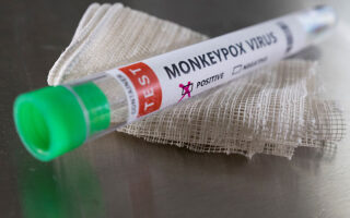 Total cases of monkeypox in Greece rise to 50
