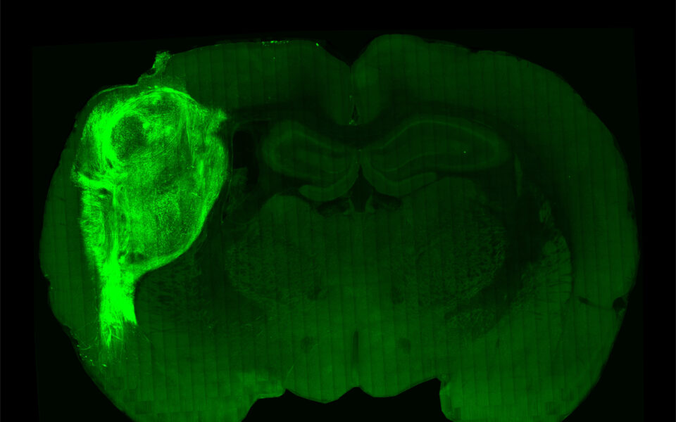Human brain cells grow in rats, and feel what the rats feel