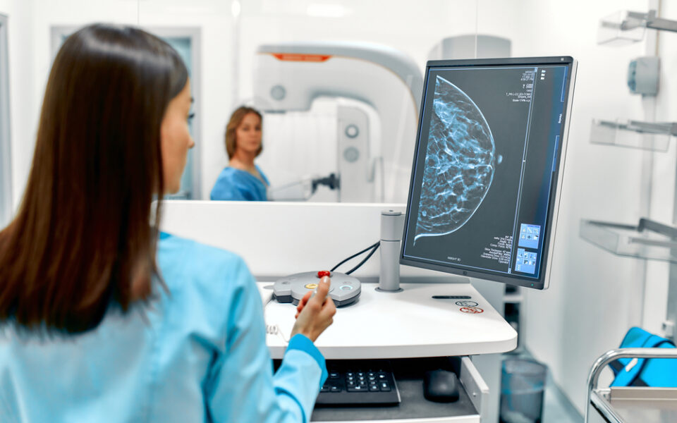 Greece has most mammography units in EU
