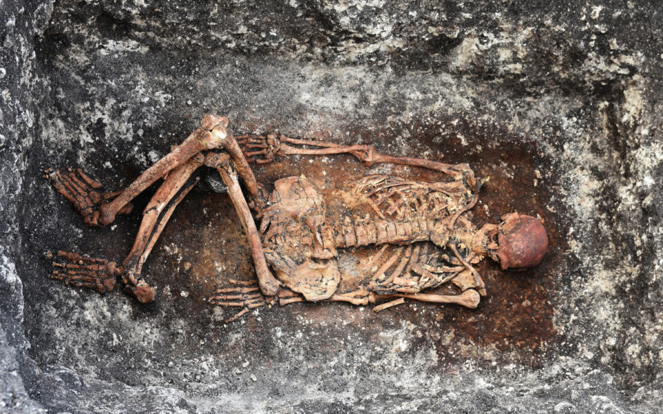 Ancient skeletons give clues to modern medical mysteries